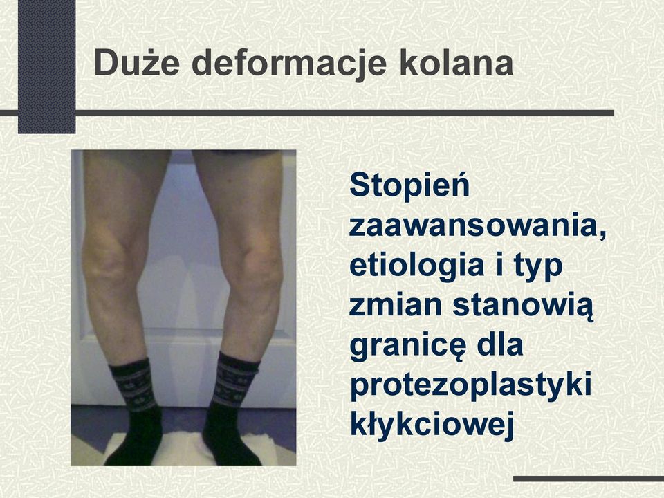 etiologia i typ zmian