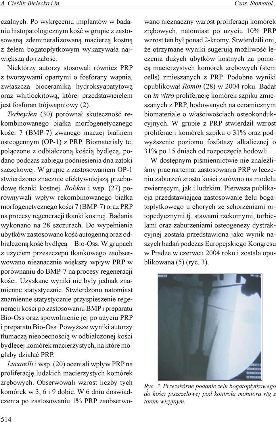 Niektórzy autorzy stosowali również PRP z tworzywami opartymi o fosforany wapnia, zwłaszcza bioceramiką hydroksyapatytową oraz whitlockitową, której przedstawicielem jest fosforan trójwapniowy (2).