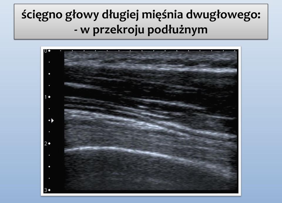 dwugłowego: - w