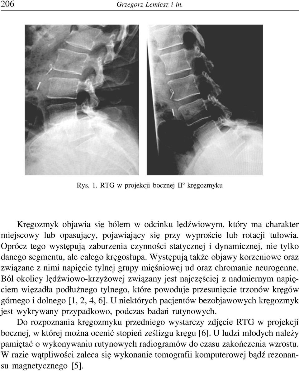 Oprócz tego występują zaburzenia czynności statycznej i dynamicznej, nie tylko danego segmentu, ale całego kręgosłupa.