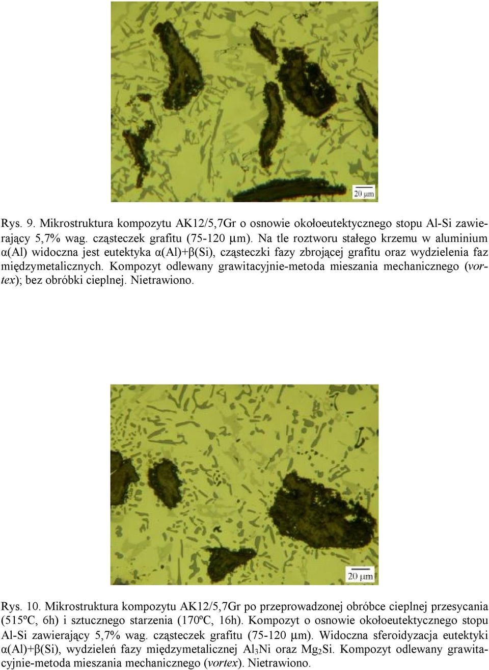 Kompozyt odlewany grawitacyjnie-metoda mieszania mechanicznego (vortex); bez obróbki cieplnej. Nietrawiono. Rys. 10.