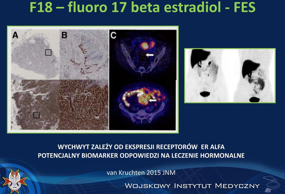 ER ΑLFA POTENCJALNY BIOMARKER