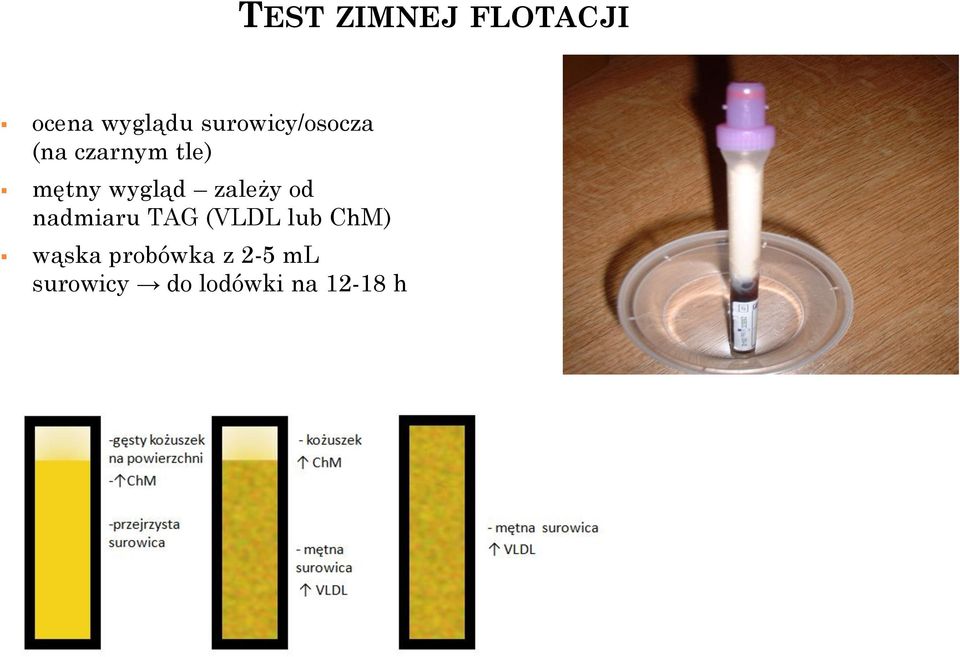 wygląd zależy od nadmiaru TAG (VLDL lub