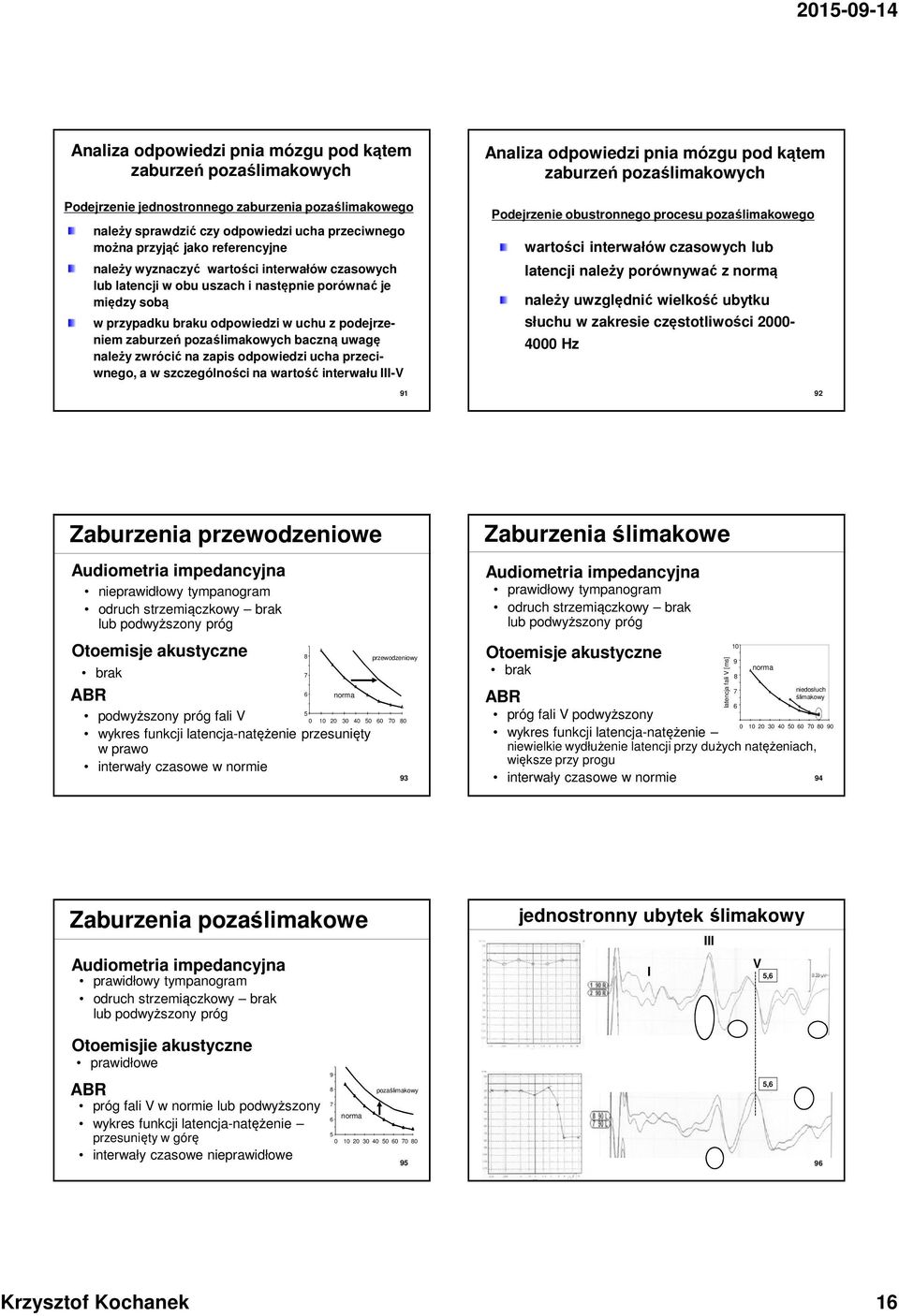 należy zwrócić na zapis odpowiedzi ucha przeciwnego, a w szczególności na wartość interwału - 91 Analiza odpowiedzi pnia mózgu pod kątem zaburzeń pozaślimakowych Podejrzenie obustronnego procesu