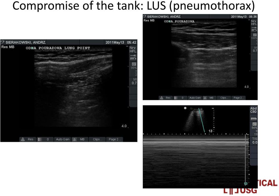 tank: LUS