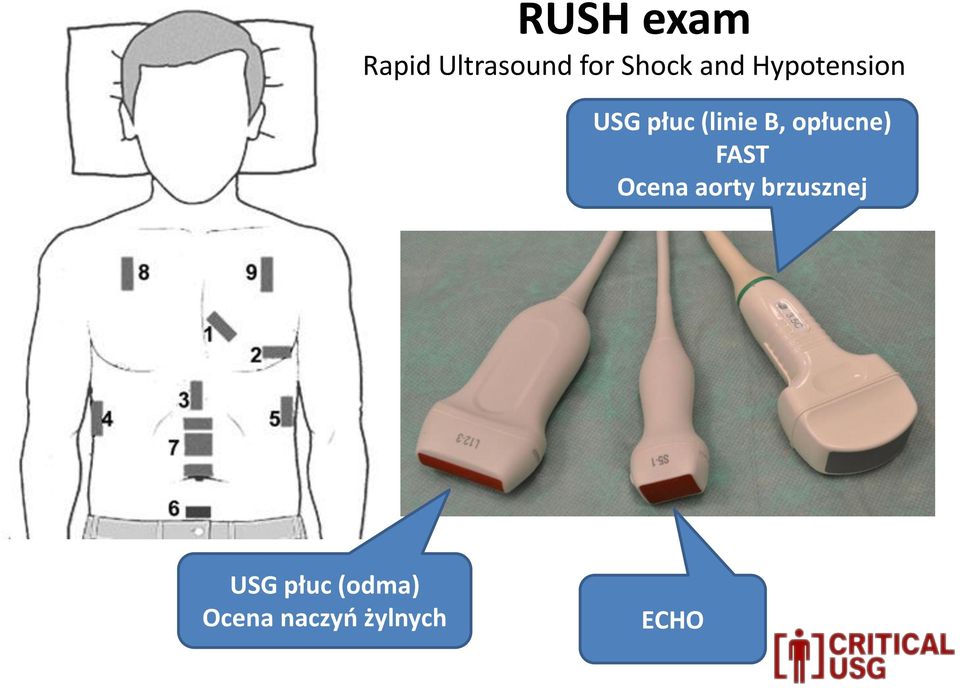 opłucne) FAST Ocena aorty brzusznej