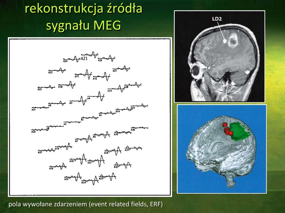 wywołane zdarzeniem