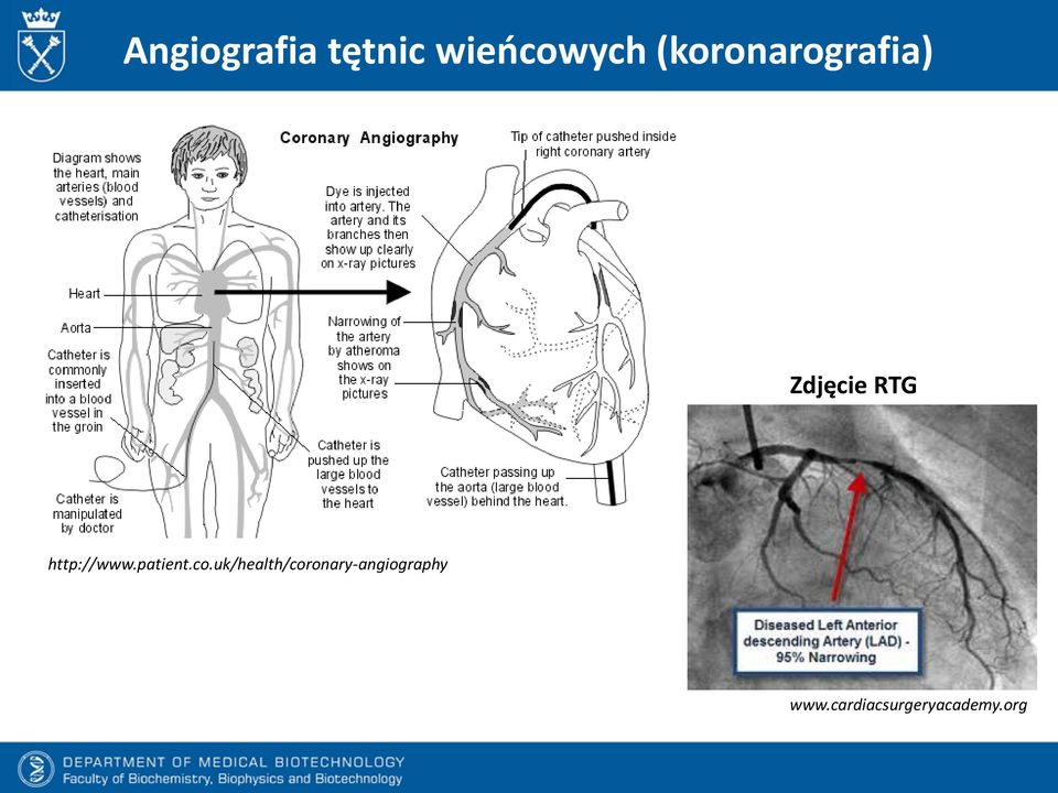 Zaburzenia Gospodarki Lipidowej Jako Czynnik Ryzyka Sercowonaczyniowego Pdf Darmowe Pobieranie 4140