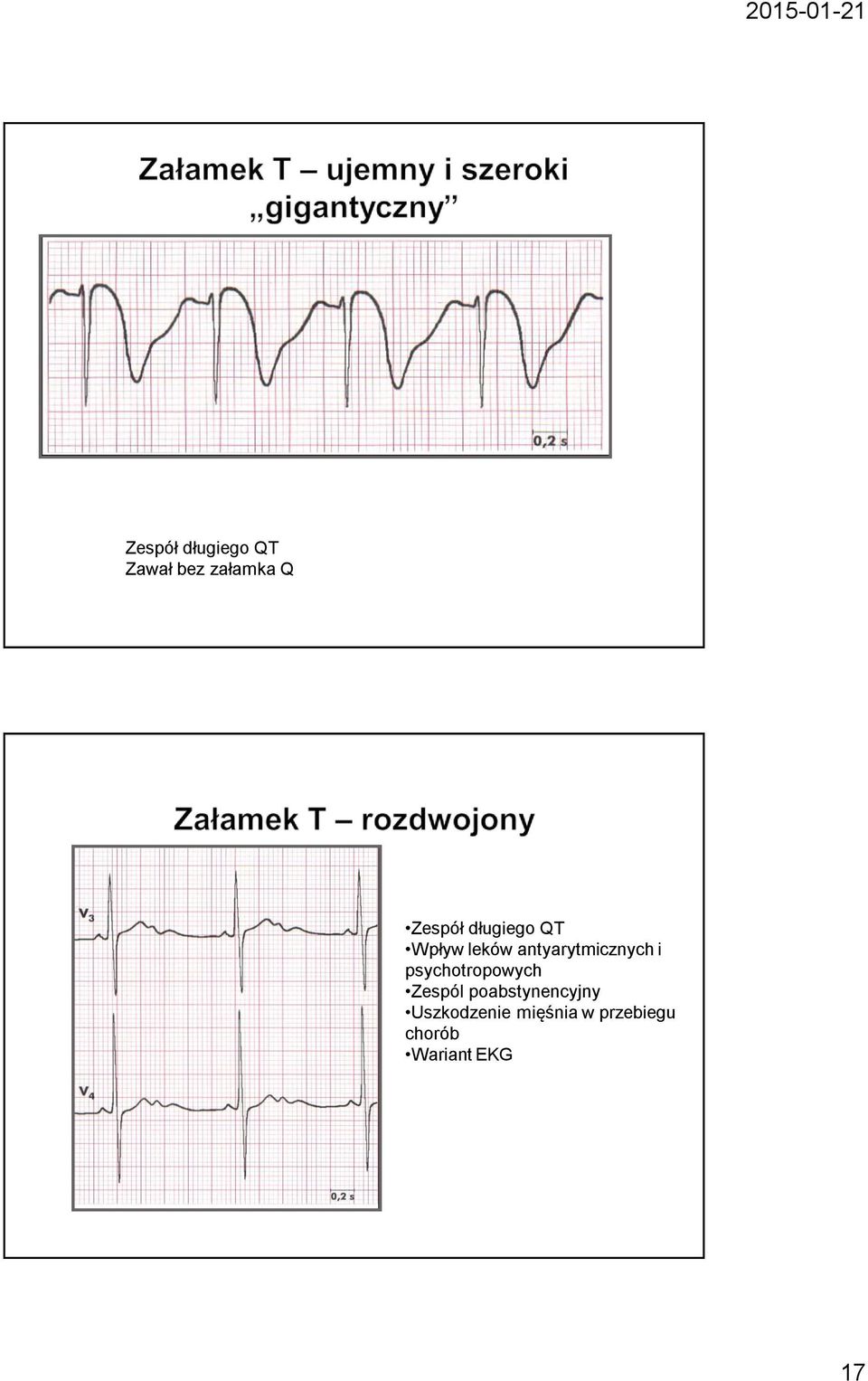 psychotropowych Zespól poabstynencyjny