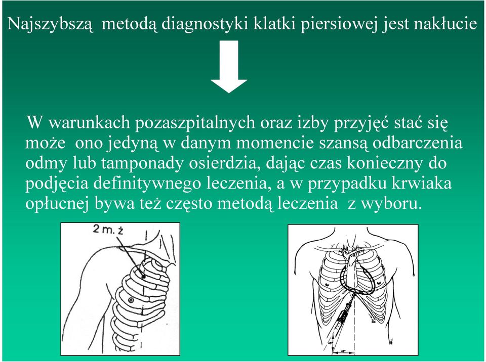 szansą odbarczenia odmy lub tamponady osierdzia, dając czas konieczny do podjęcia