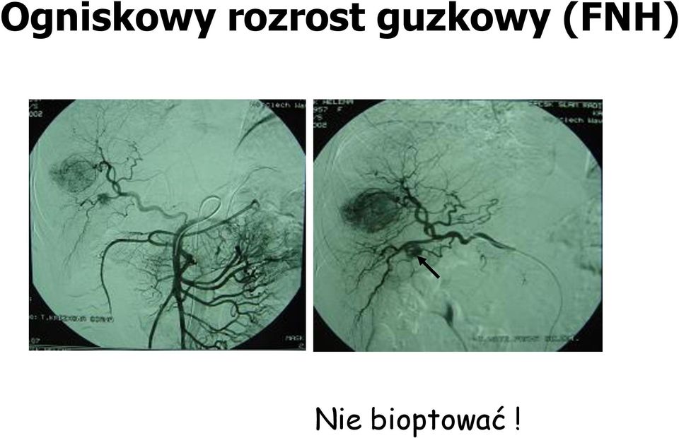 guzkowy