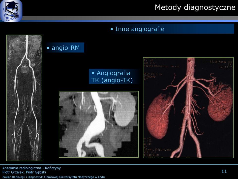 angiografie