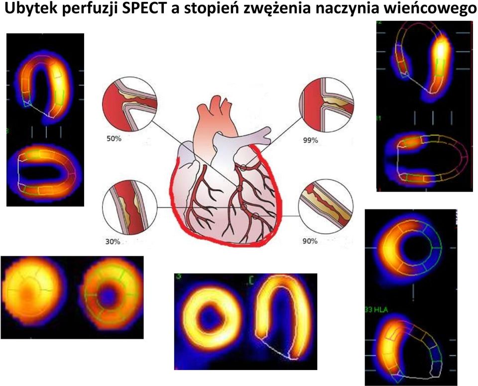 a stopień