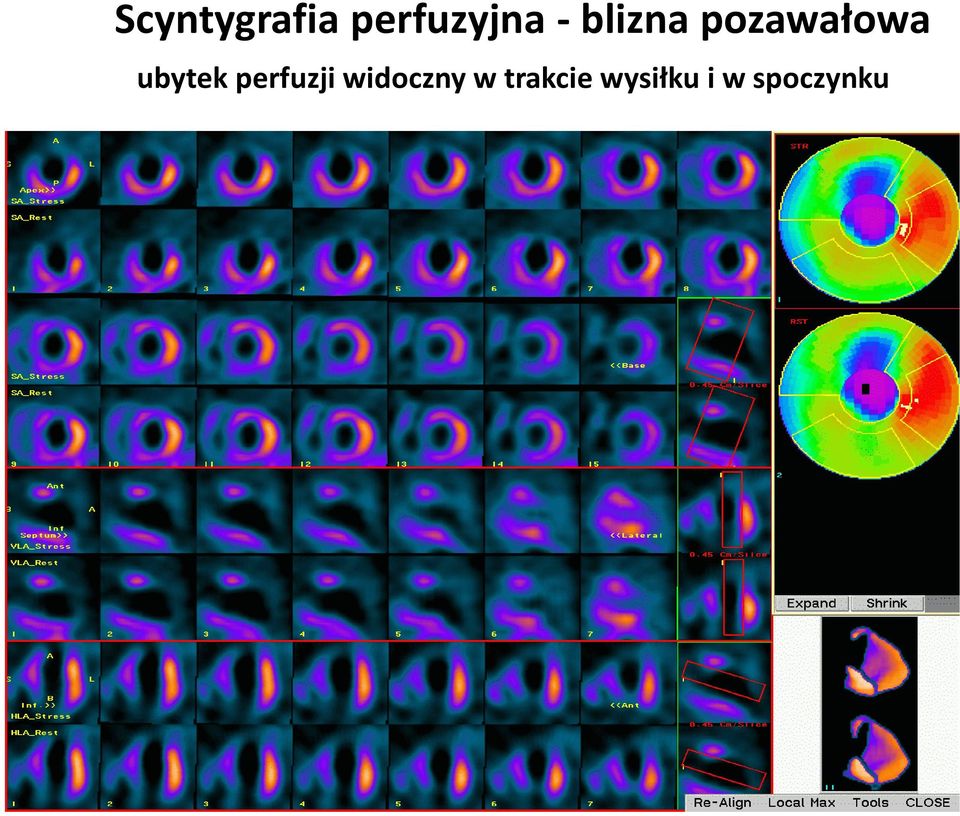 ubytek perfuzji widoczny