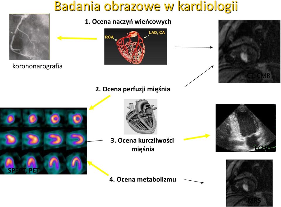 CMR 2. Ocena perfuzji mięśnia 3.