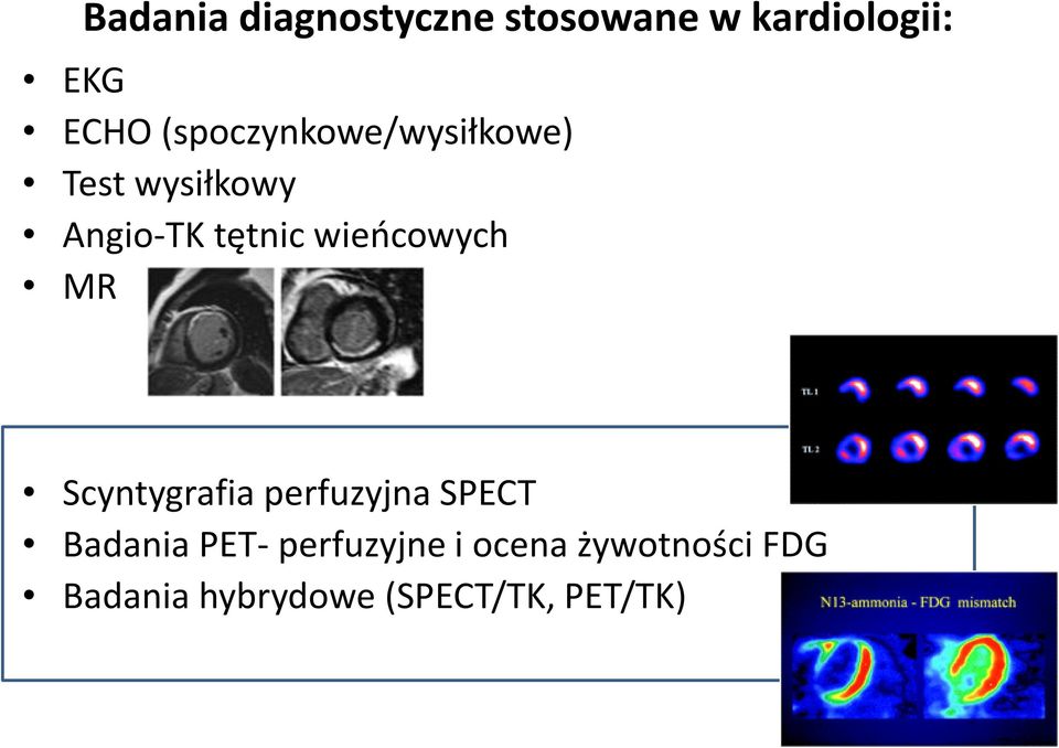 wieńcowych MR Scyntygrafia perfuzyjna SPECT Badania PET-