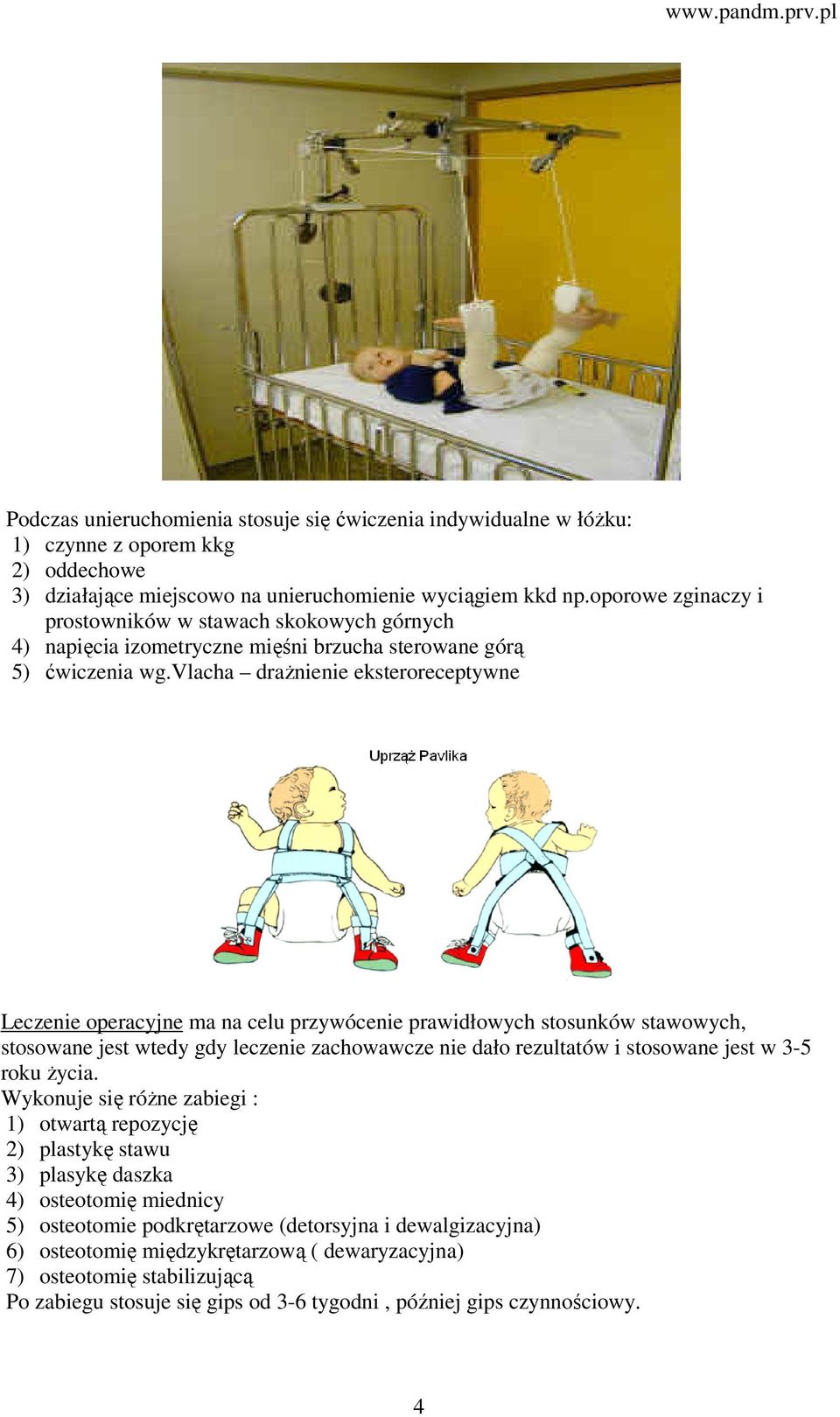 vlacha drażnienie eksteroreceptywne Leczenie operacyjne ma na celu przywócenie prawidłowych stosunków stawowych, stosowane jest wtedy gdy leczenie zachowawcze nie dało rezultatów i stosowane jest w