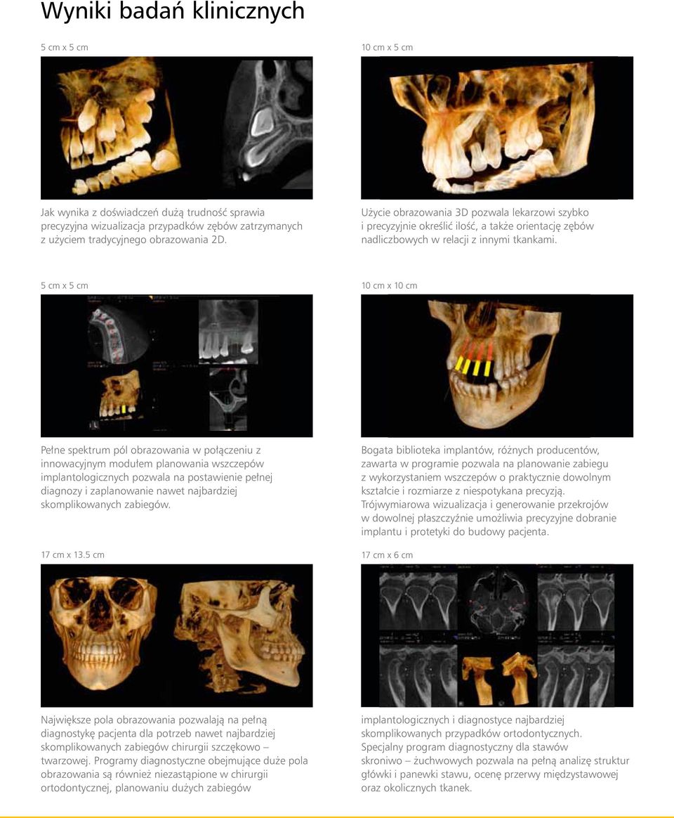 5 cm x 5 cm 10 cm x 10 cm Pełne spektrum pól obrazowania w połączeniu z innowacyjnym modułem planowania wszczepów implantologicznych pozwala na postawienie pełnej diagnozy i zaplanowanie nawet