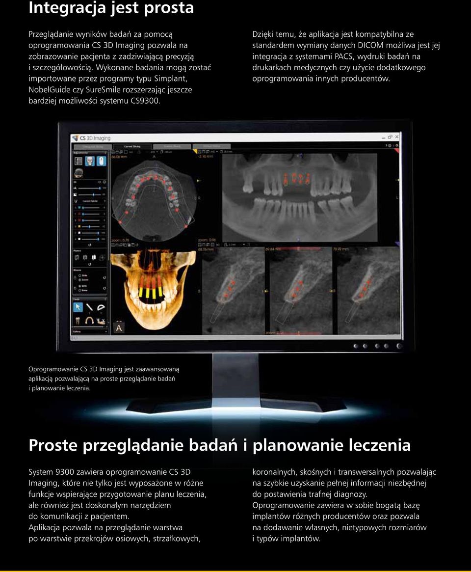 Dzięki temu, że aplikacja jest kompatybilna ze standardem wymiany danych DICOM możliwa jest jej integracja z systemami PACS, wydruki badań na drukarkach medycznych czy użycie dodatkowego