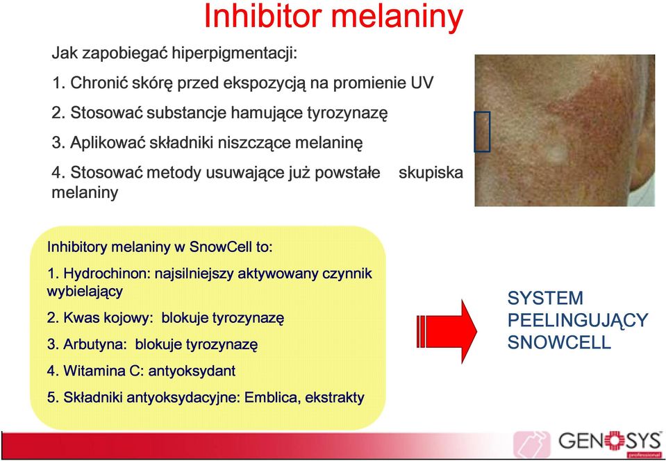 Stosować metody usuwające już powstałe skupiska melaniny Inhibitory melaniny w SnowCell to: 1.