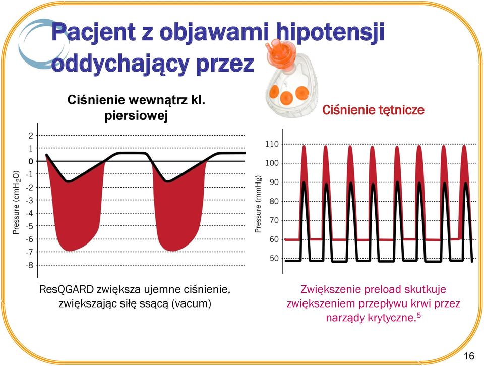 piersiowej Ciśnienie tętnicze ResQGARD zwiększa ujemne