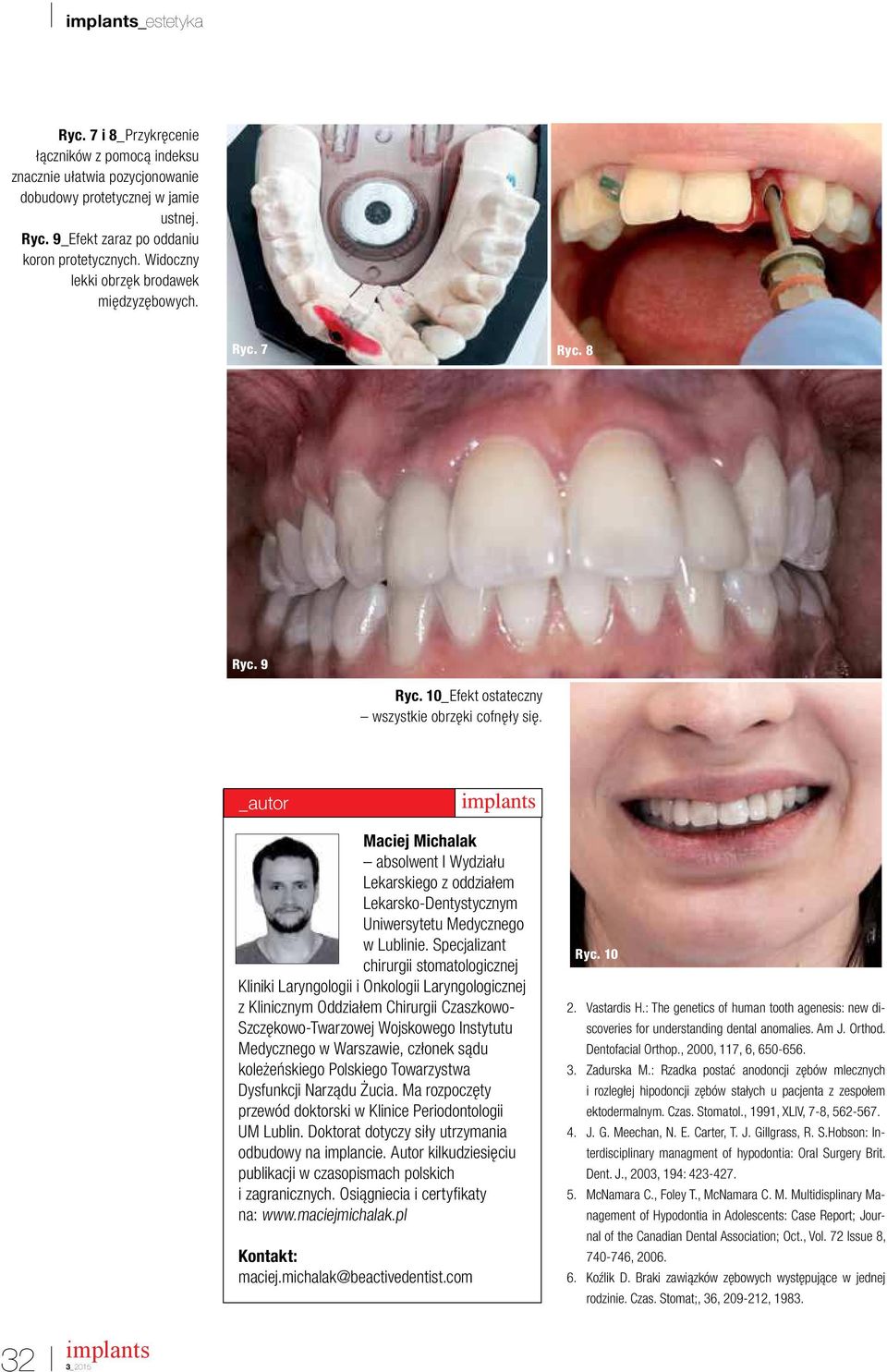 _autor Maciej Michalak absolwent I Wydziału Lekarskiego z oddziałem Lekarsko-Dentystycznym Uniwersytetu Medycznego w Lublinie.