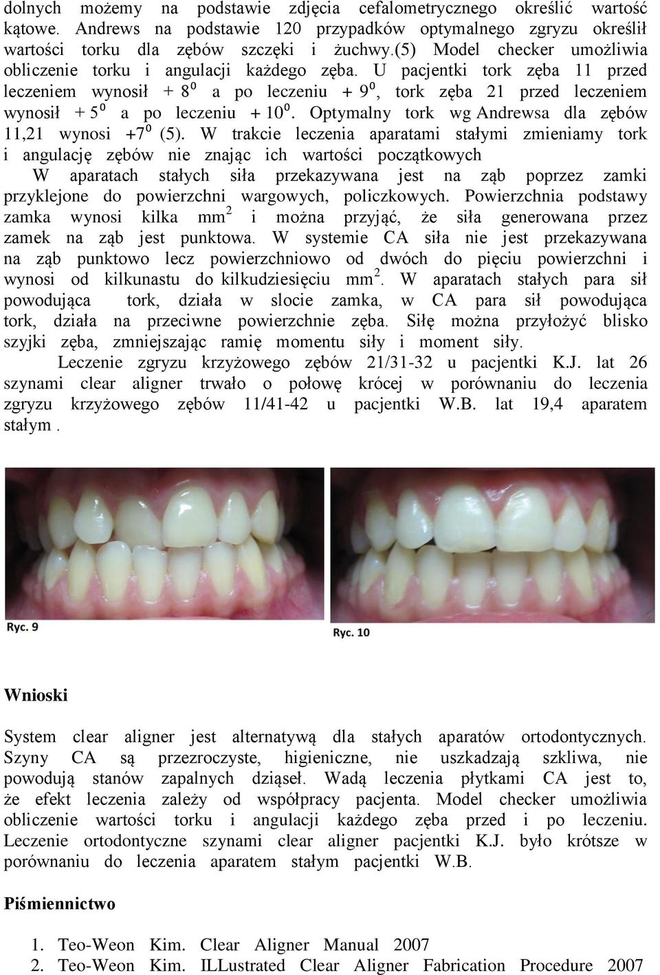 U pacjentki tork zęba 11 przed leczeniem wynosił + 8⁰ a po leczeniu + 9⁰, tork zęba 21 przed leczeniem wynosił + 5⁰ a po leczeniu + 10⁰. Optymalny tork wg Andrewsa dla zębów 11,21 wynosi +7⁰ (5).