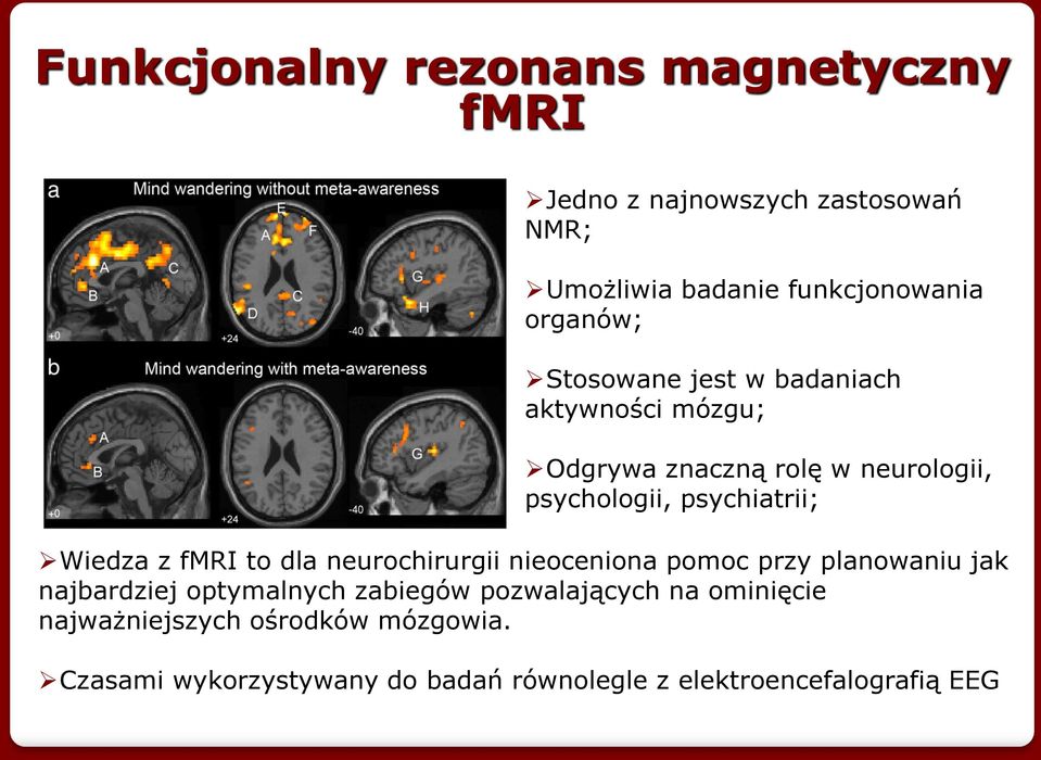 Wiedza z fmri to dla neurochirurgii nieoceniona pomoc przy planowaniu jak najbardziej optymalnych zabiegów