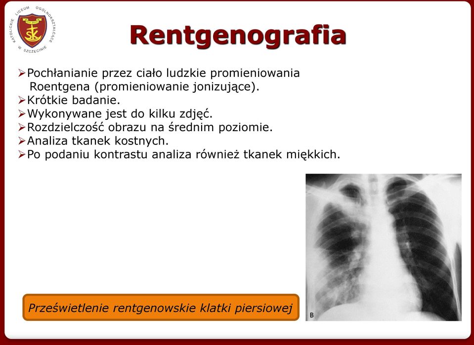 Rozdzielczość obrazu na średnim poziomie. Analiza tkanek kostnych.