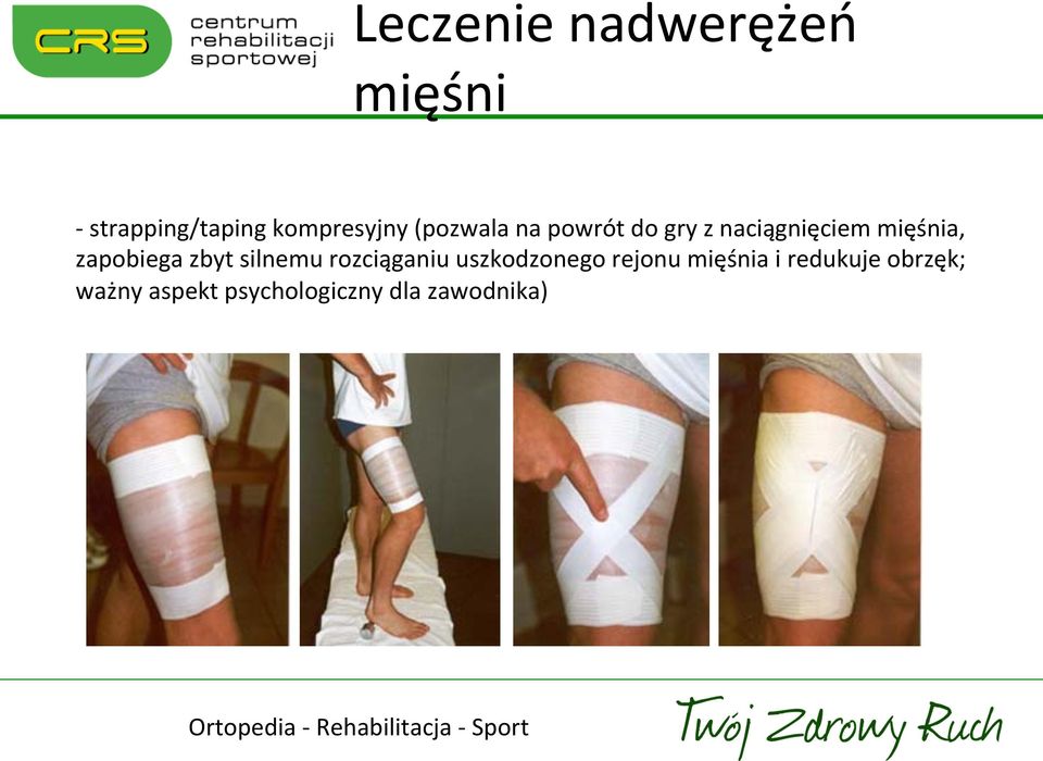 zapobiega zbyt silnemu rozciąganiu uszkodzonego rejonu