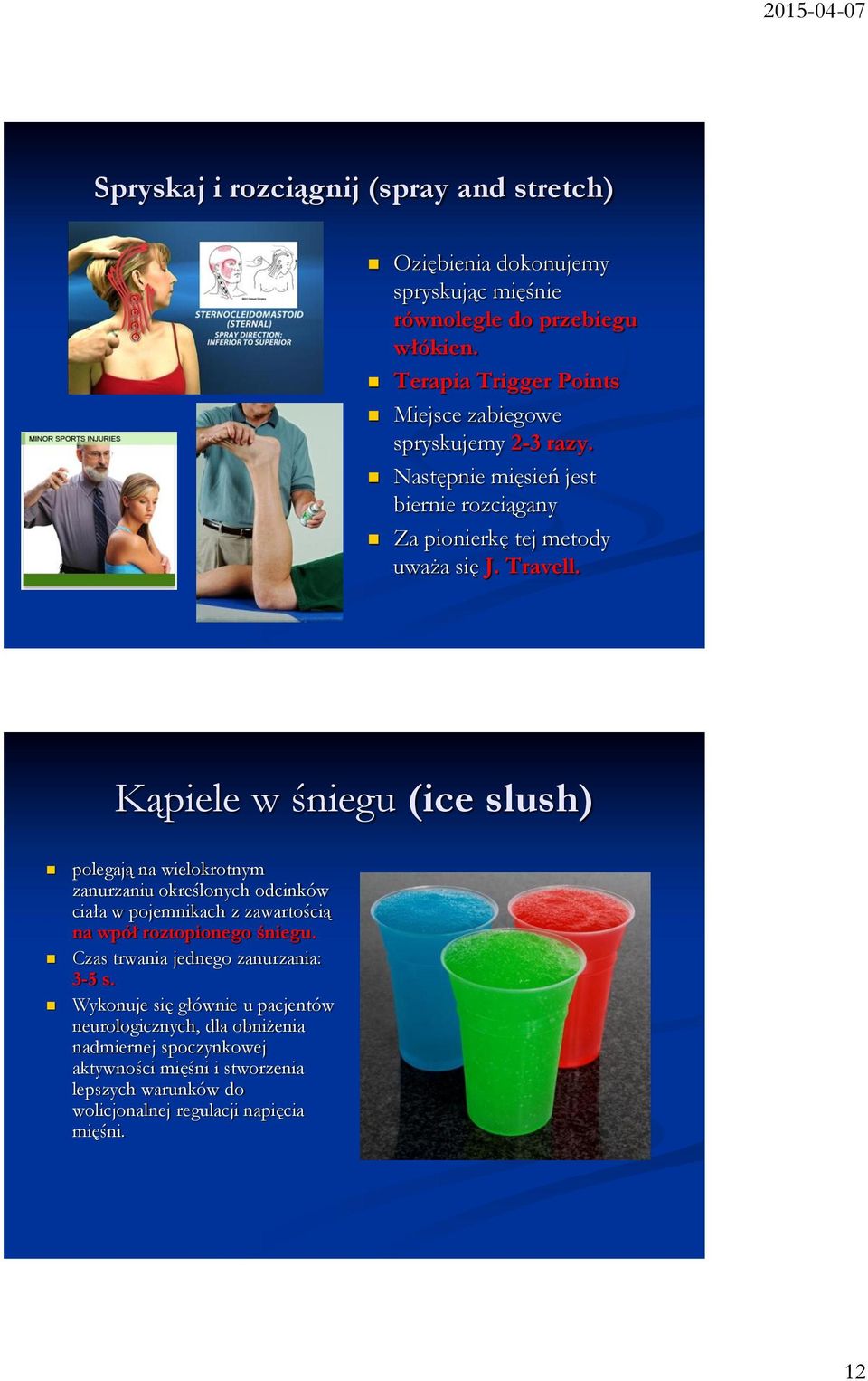 Kąpiele w śniegu (ice slush) polegają na wielokrotnym zanurzaniu określonych odcinków ciała w pojemnikach z zawartością na wpół roztopionego śniegu.