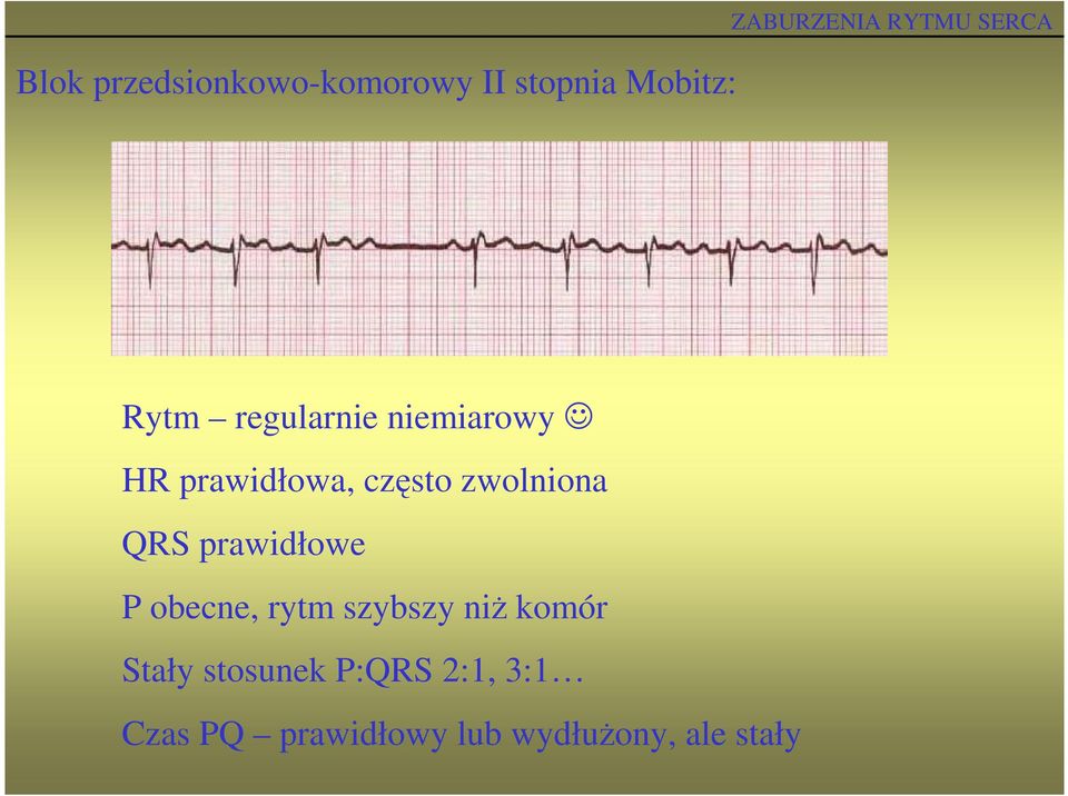 zwolniona QRS prawidłowe P obecne, rytm szybszy niŝ komór