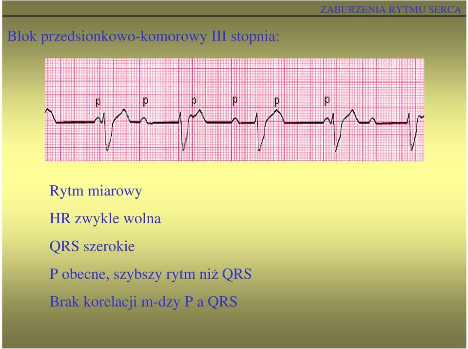 wolna QRS szerokie P obecne,