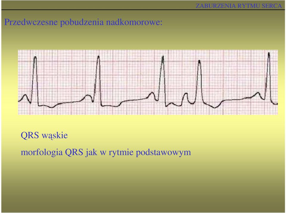 nadkomorowe: QRS