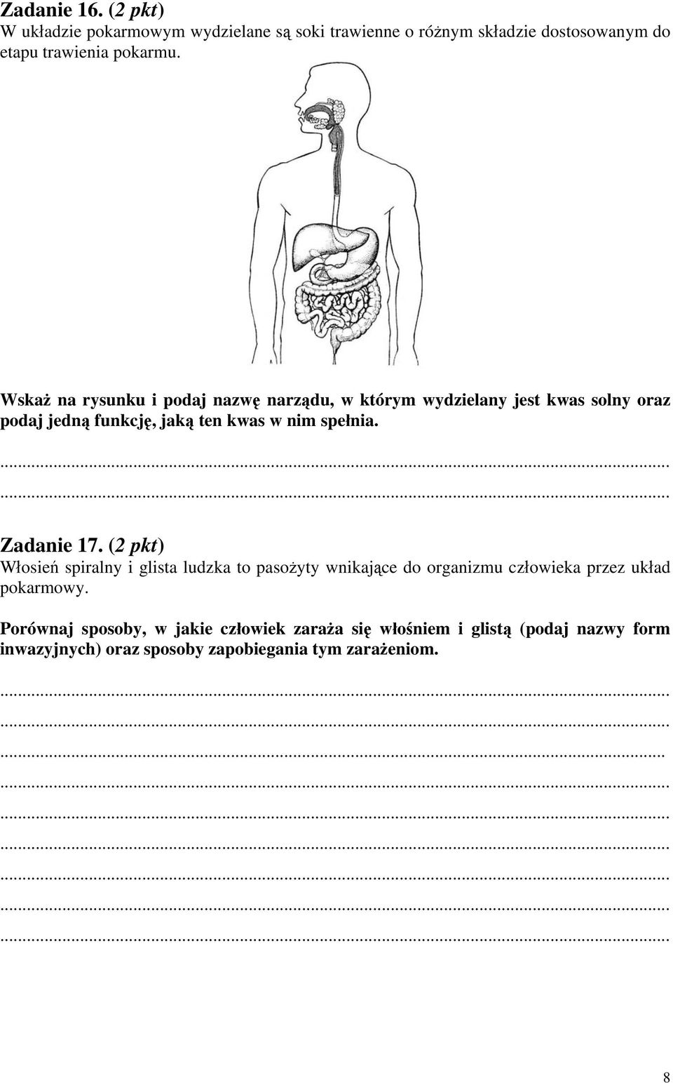 Zadanie 17. (2 pkt) Włosień spiralny i glista ludzka to pasożyty wnikające do organizmu człowieka przez układ pokarmowy.