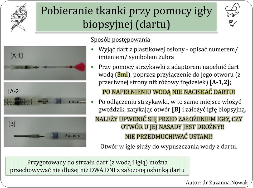 Po odłączeniu strzykawki, w to samo miejsce włożyć gwoździk, zatykając otwór [B] i założyć igłę biopsyjną. NALEŻY UPWENIĆ SIĘ PRZED ZAŁOŻENIEM IGŁY, CZY OTWÓR U JEJ NASADY JEST DROŻNY!