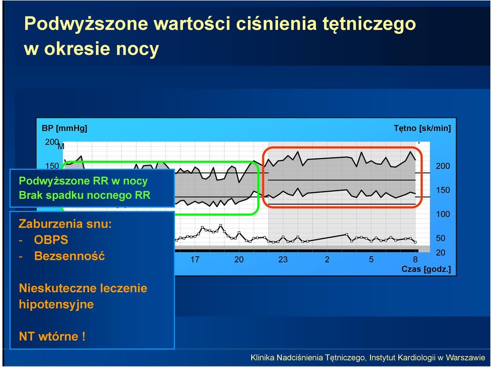 Bezsenność 0 50 20 8 11 14 17 20 23 2 5 8 Thursday, June 29, 2006 Czas [godz.