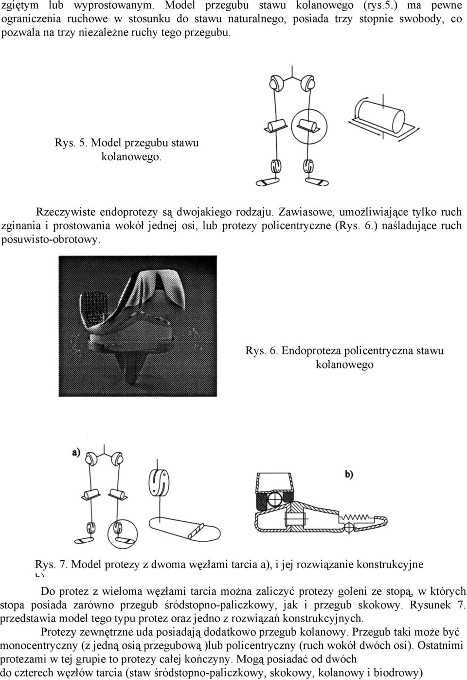Rzeczywiste endoprotezy są dwojakiego rodzaju. Zawiasowe, umożliwiające tylko ruch zginania i prostowania wokół jednej osi, lub protezy policentryczne (Rys. 6.) naśladujące ruch posuwisto-obrotowy.