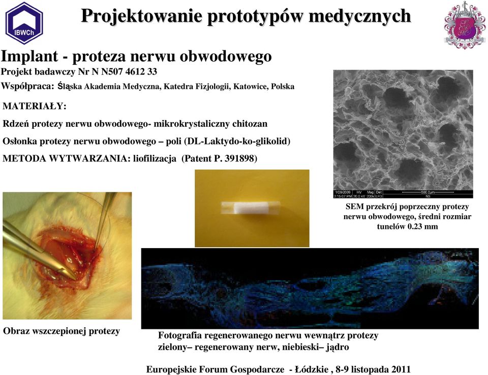 obwodowego poli (DL-Laktydo-ko-glikolid) METODA WYTWARZANIA: liofilizacja (Patent P.