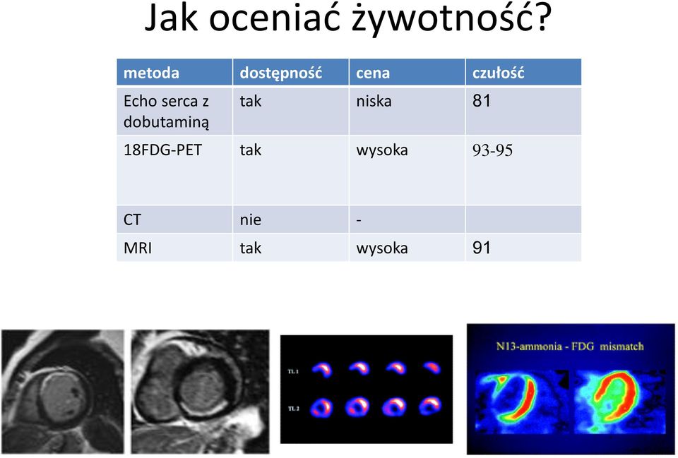 serca z dobutaminą tak niska 81