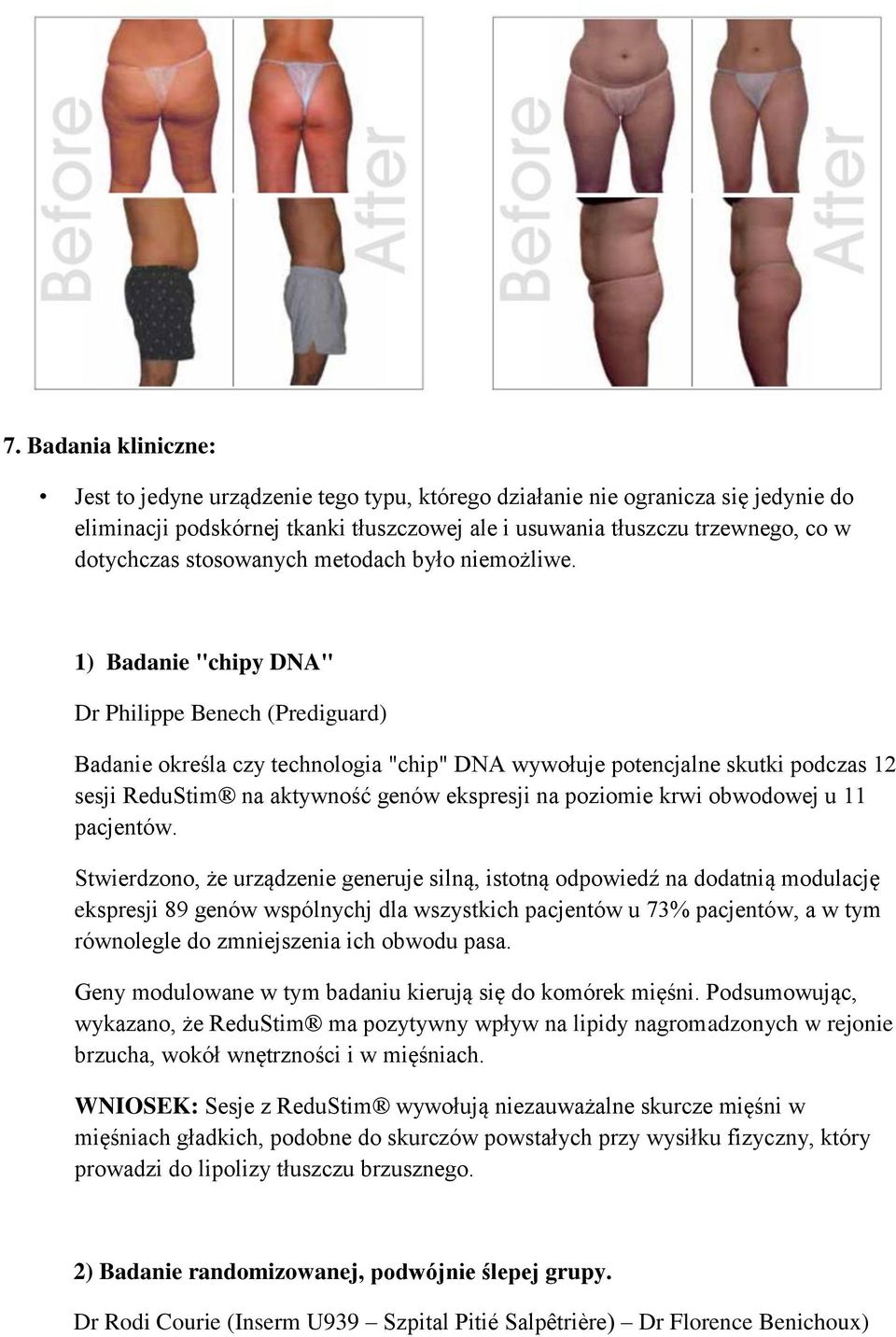 1) Badanie "chipy DNA" Dr Philippe Benech (Prediguard) Badanie określa czy technologia "chip" DNA wywołuje potencjalne skutki podczas 12 sesji ReduStim na aktywność genów ekspresji na poziomie krwi