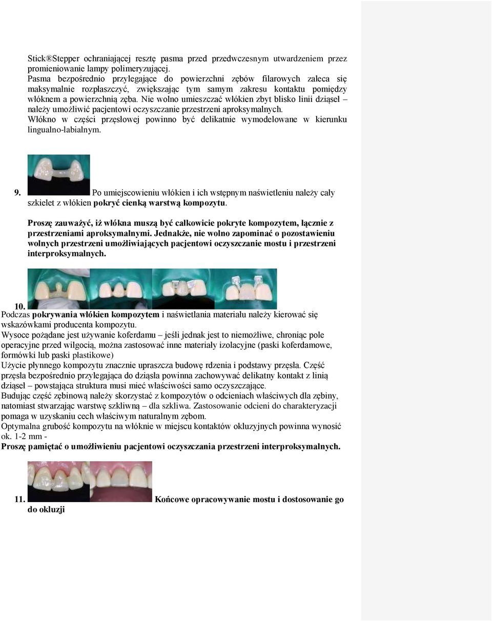 Nie wolno umieszczać włókien zbyt blisko linii dziąseł należy umożliwić pacjentowi oczyszczanie przestrzeni aproksymalnych.