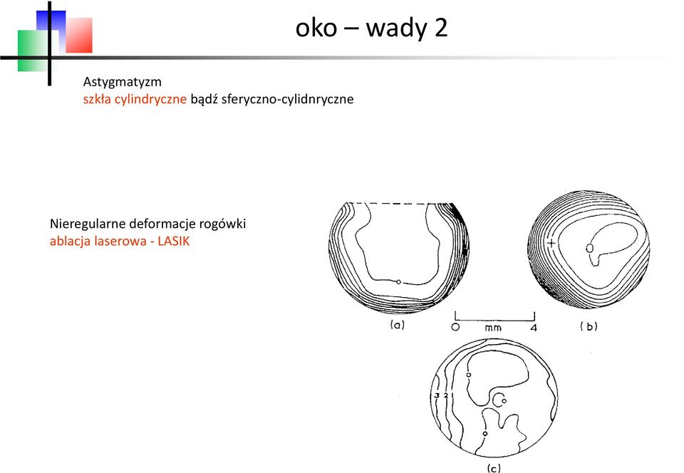 sferyczno-cylidnryczne