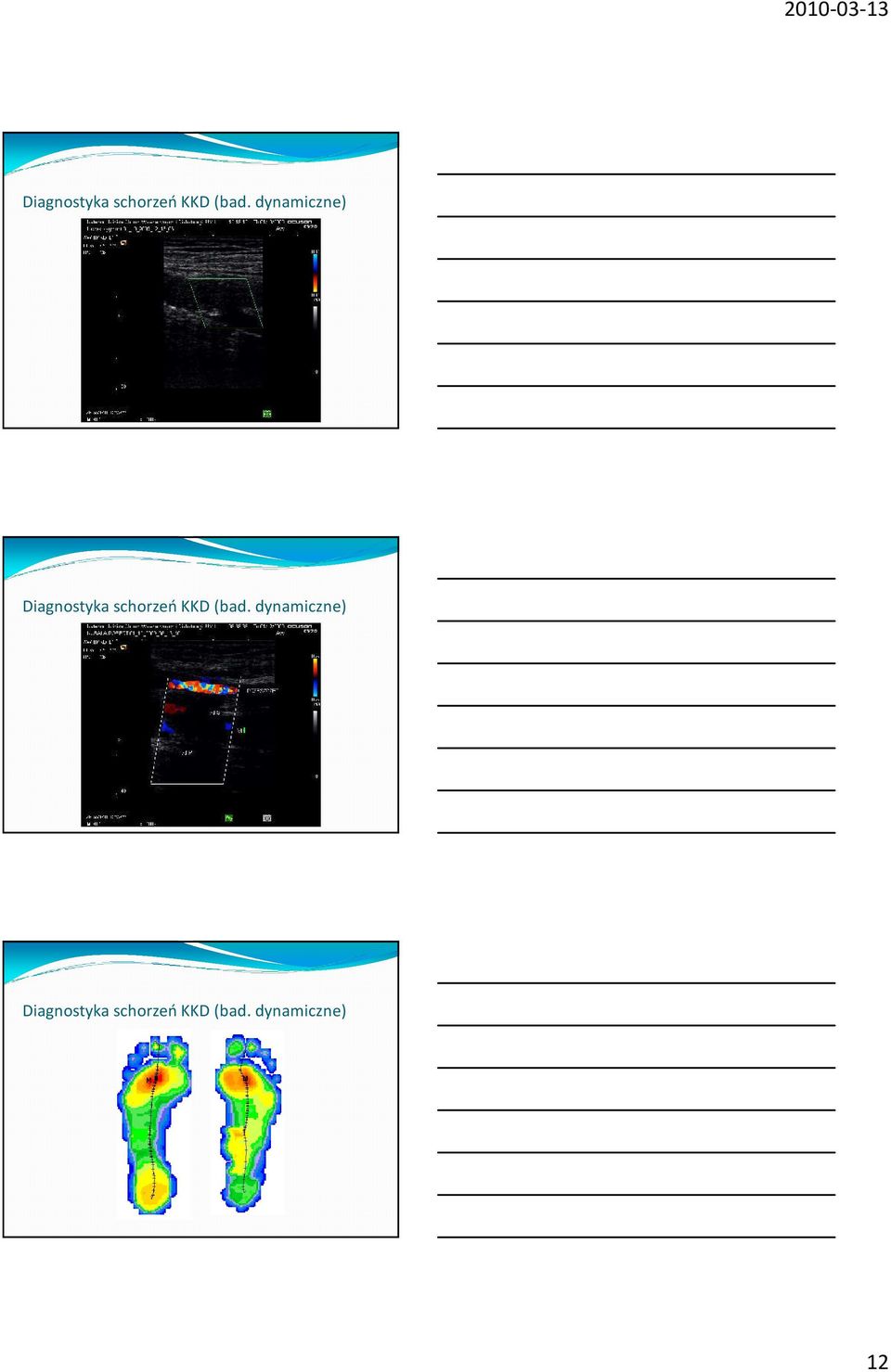 dynamiczne) 12