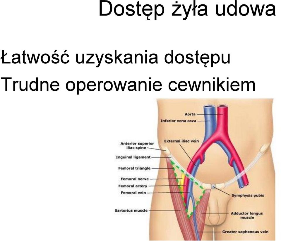 dostępu Trudne