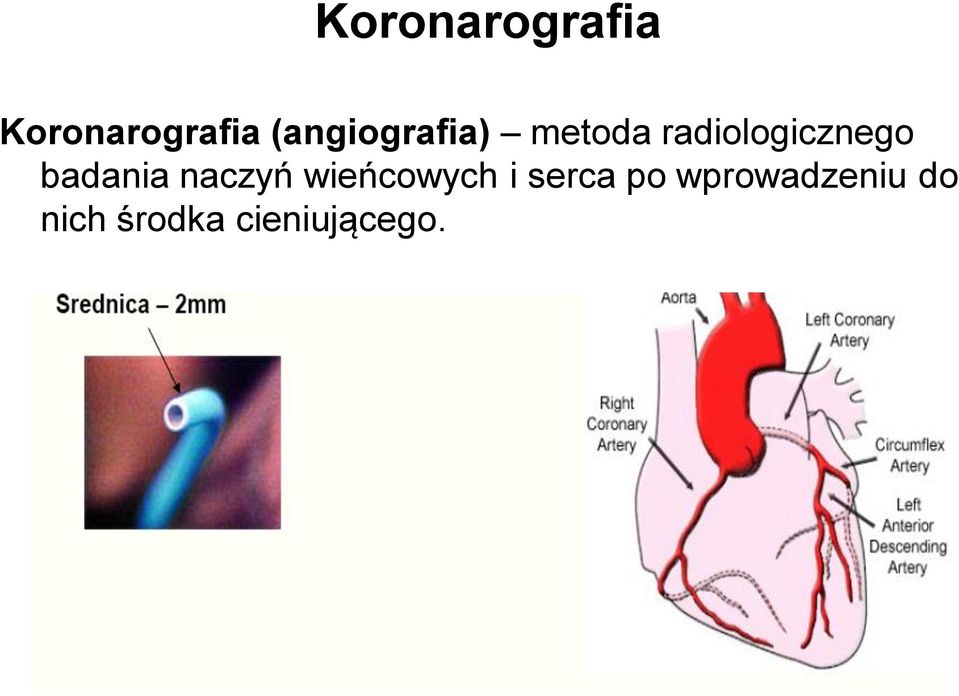 badania naczyń wieńcowych i serca po