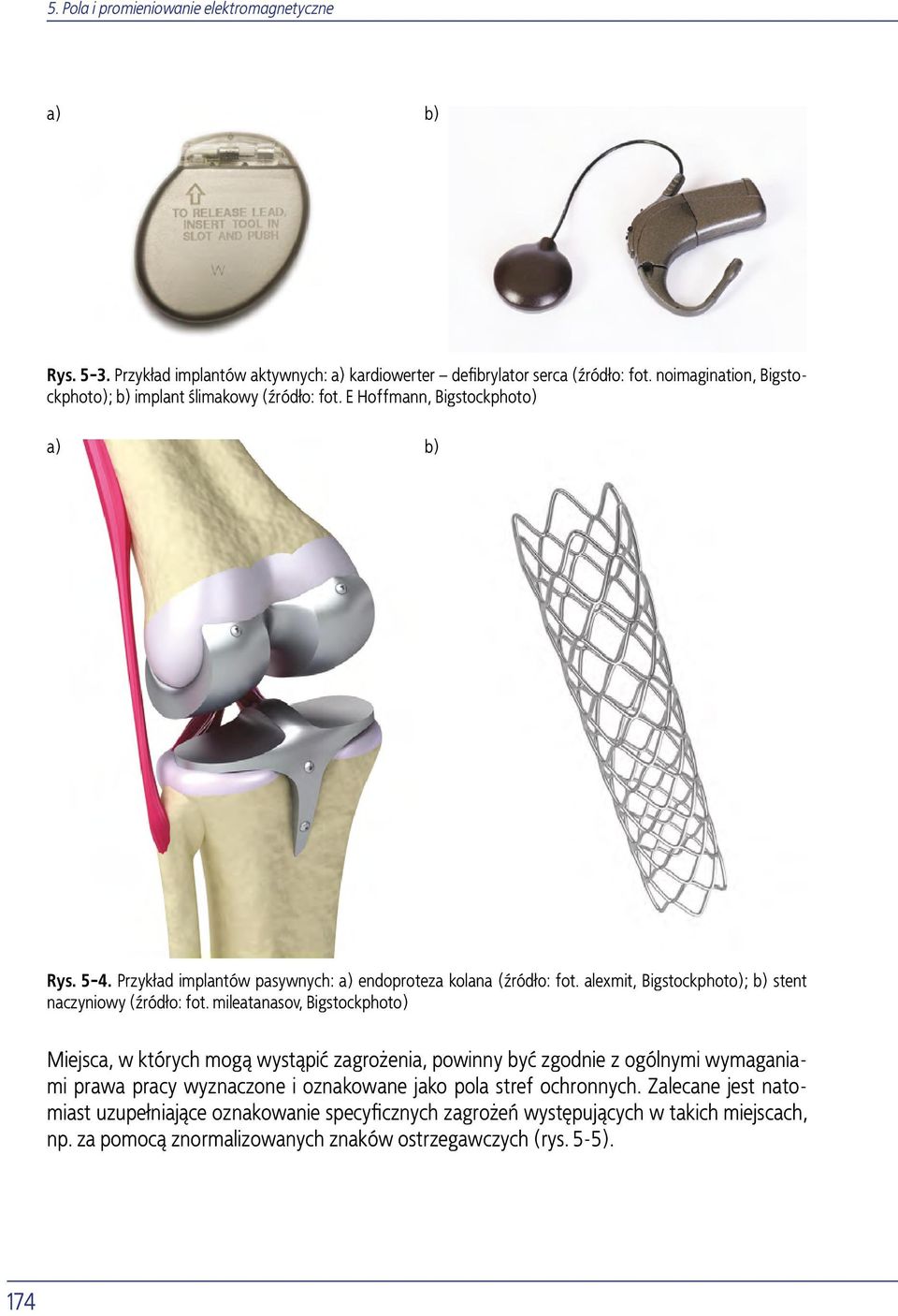 alexmit, Bigstockphoto); b) stent naczyniowy (źródło: fot.