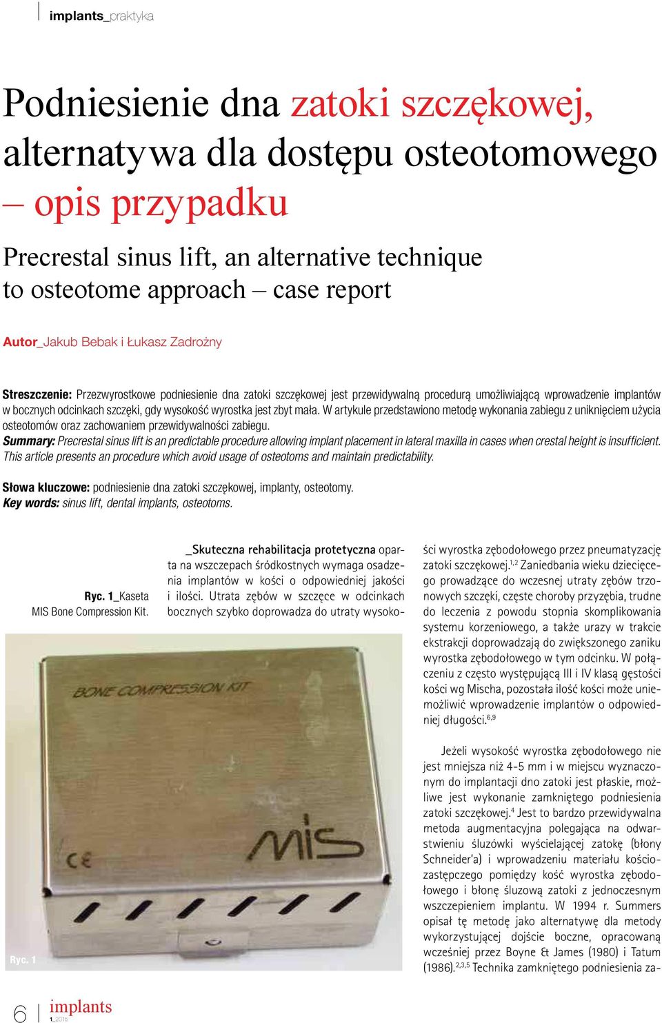 wyrostka jest zbyt mała. W artykule przedstawiono metodę wykonania zabiegu z uniknięciem użycia osteotomów oraz zachowaniem przewidywalności zabiegu.
