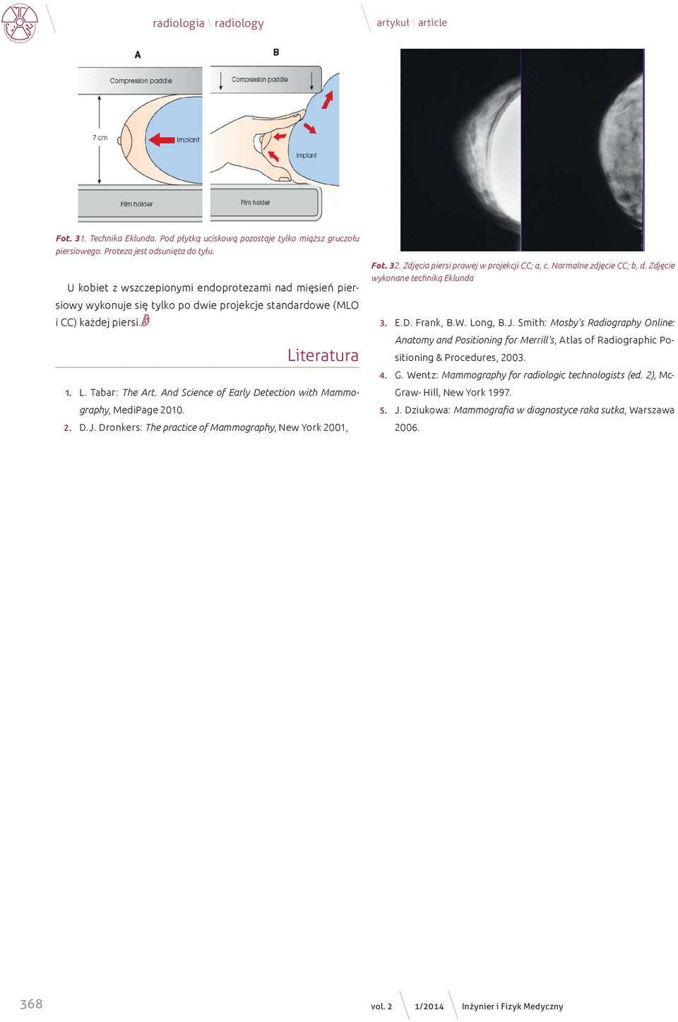 And Science of Early Detection with Mammography, MediPage 2010. 2. D.J. Dronkers: The practice of Mammography, New York 2001, Fot. 32. Zdjęcia piersi prawej w projekcji CC; a, c.