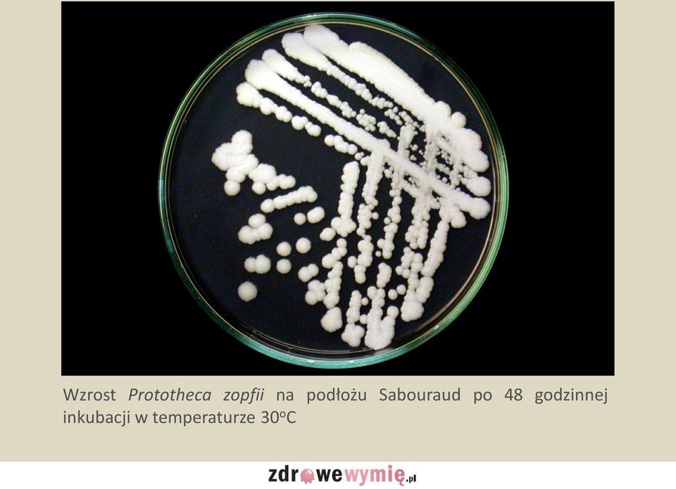 Sabouraud po 48
